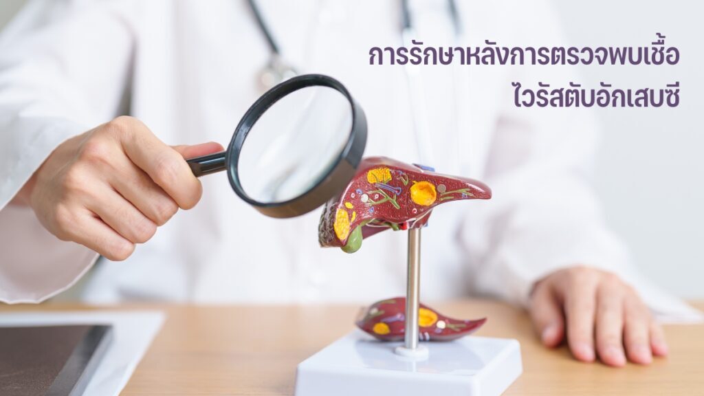 แพทย์ถือแว่นขยายข้างแบบจำลองตับ ประกอบหัวข้อการรักษาหลังยืนยันเชื้อไวรัสตับอักเสบซี