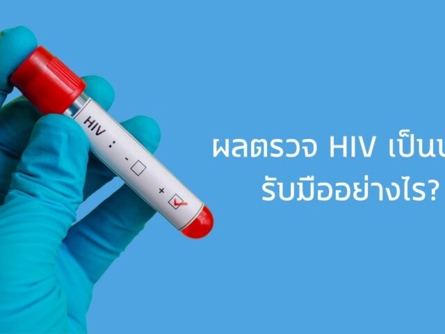 ผลตรวจ HIV เป็นบวก รับมืออย่างไร?