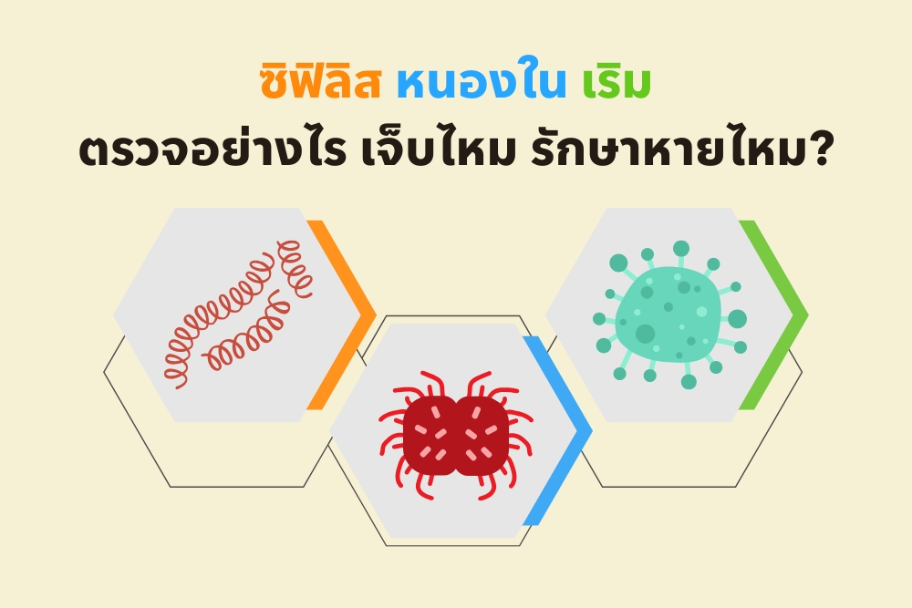 ซิฟิลิส หนองใน เริม : ตรวจอย่างไร เจ็บไหม รักษาหายไหม?